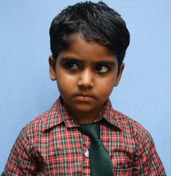 ANVI 
